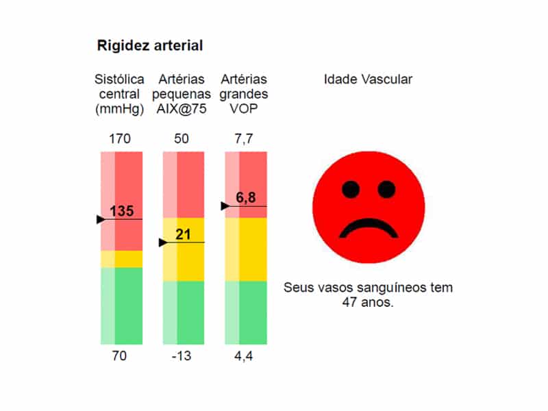 VOP - Idade Vascular - Medida de Pressão Arterial